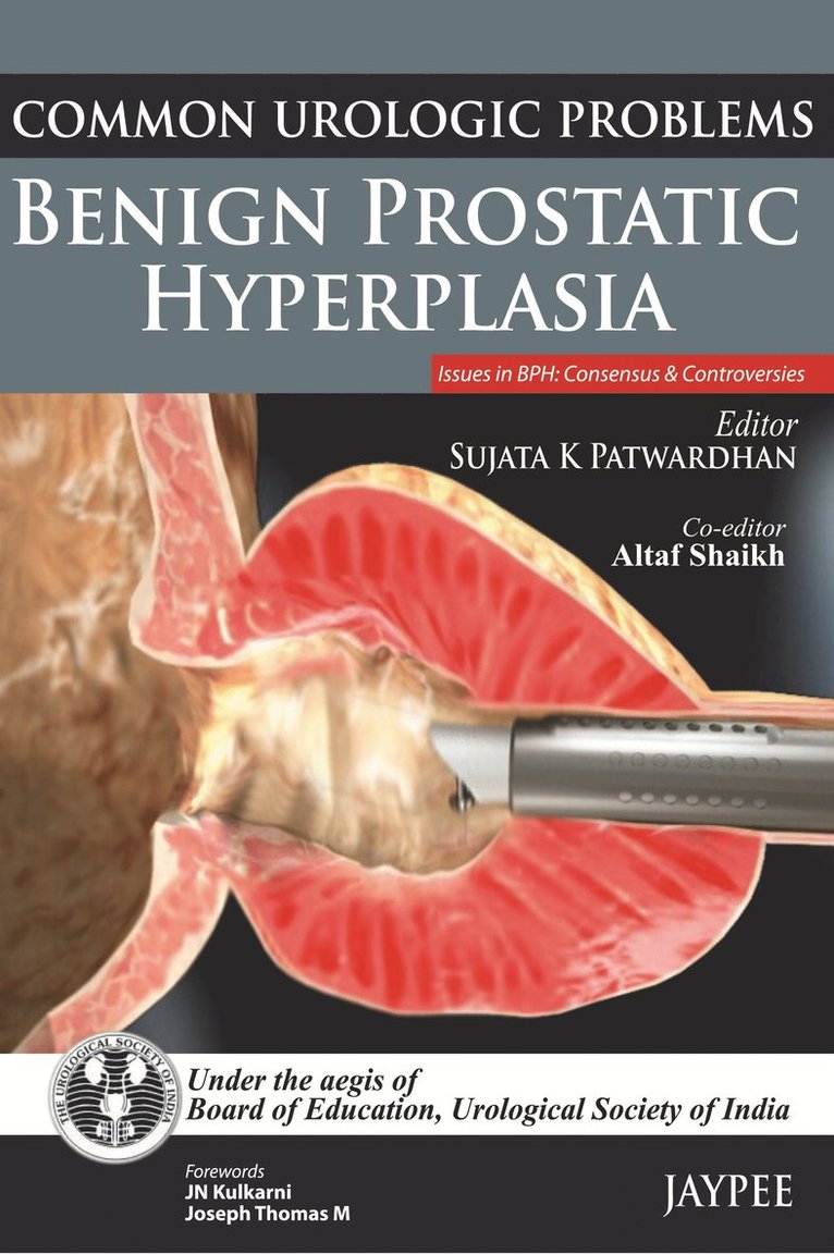 Common Urologic Problems: Benign Prostatic Hyperplasia 1