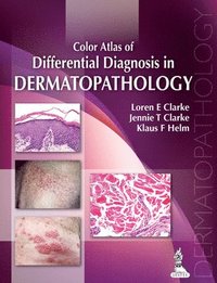 bokomslag Color Atlas of Differential Diagnosis in Dermatopathology