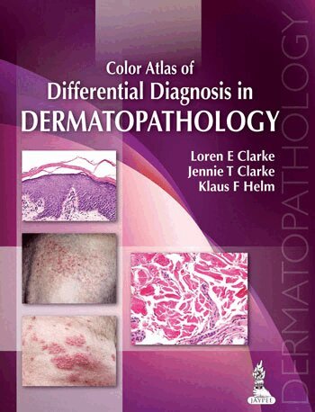 Loren E Clarke, Jennie T Clarke, Klaus F Helm - Color Atlas of Differential Diagnosis in Dermatopathology, Inbunden