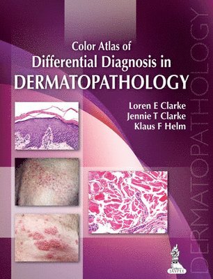 Color Atlas of Differential Diagnosis in Dermatopathology 1