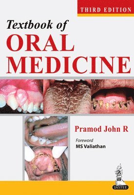 bokomslag Textbook of Oral Medicine