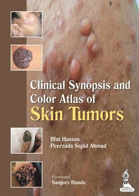 bokomslag Clinical Synopsis and Color Atlas of Skin Tumors