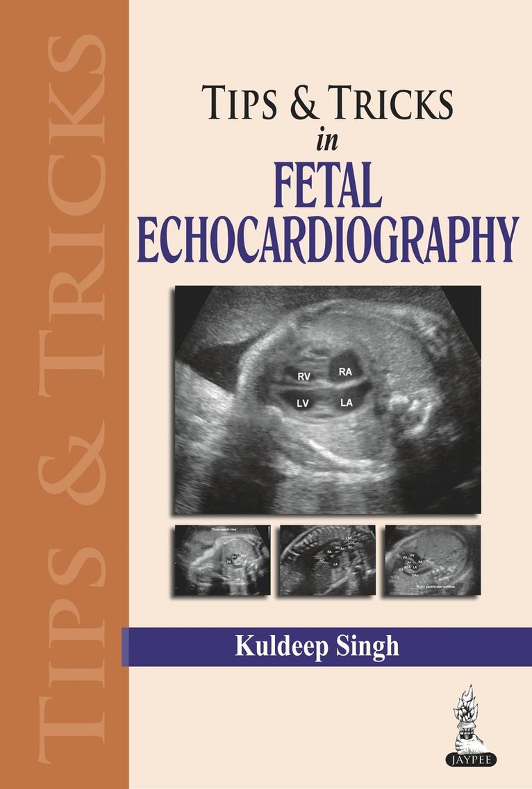 Kuldeep Singh - Tips & Tricks in Fetal Echocardiography, Häftad