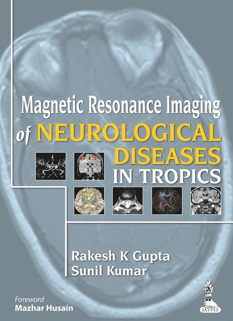 Rakesh K Gupta, Sunil Kumar - Magnetic Resonance Imaging of Neurological Diseases in Tropics, Inbunden