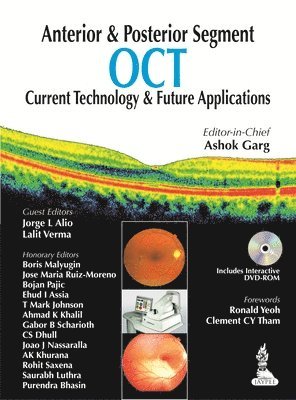 bokomslag Anterior & Posterior Segment OCT: Current Technology & Future Applications