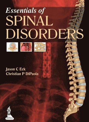 bokomslag Essentials of Spinal Disorders