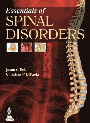 Jason C Eck, Christian P DiPaola - Essentials of Spinal Disorders, Inbunden