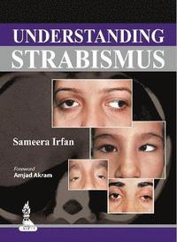 bokomslag Understanding Strabismus