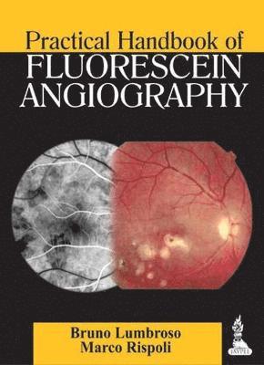 Bruno Lumbroso, Marco Rispoli - Practical Handbook of Fluorescein Angiography, Häftad