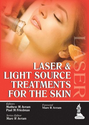 Laser and Light Source Treatments for the Skin 1
