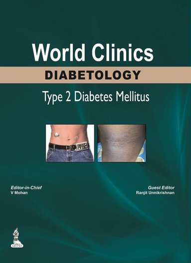 V Mohan, Ranjit Unnikrishnan - World Clinics: Diabetology - Type 2 Diabetes Mellitus, Inbunden