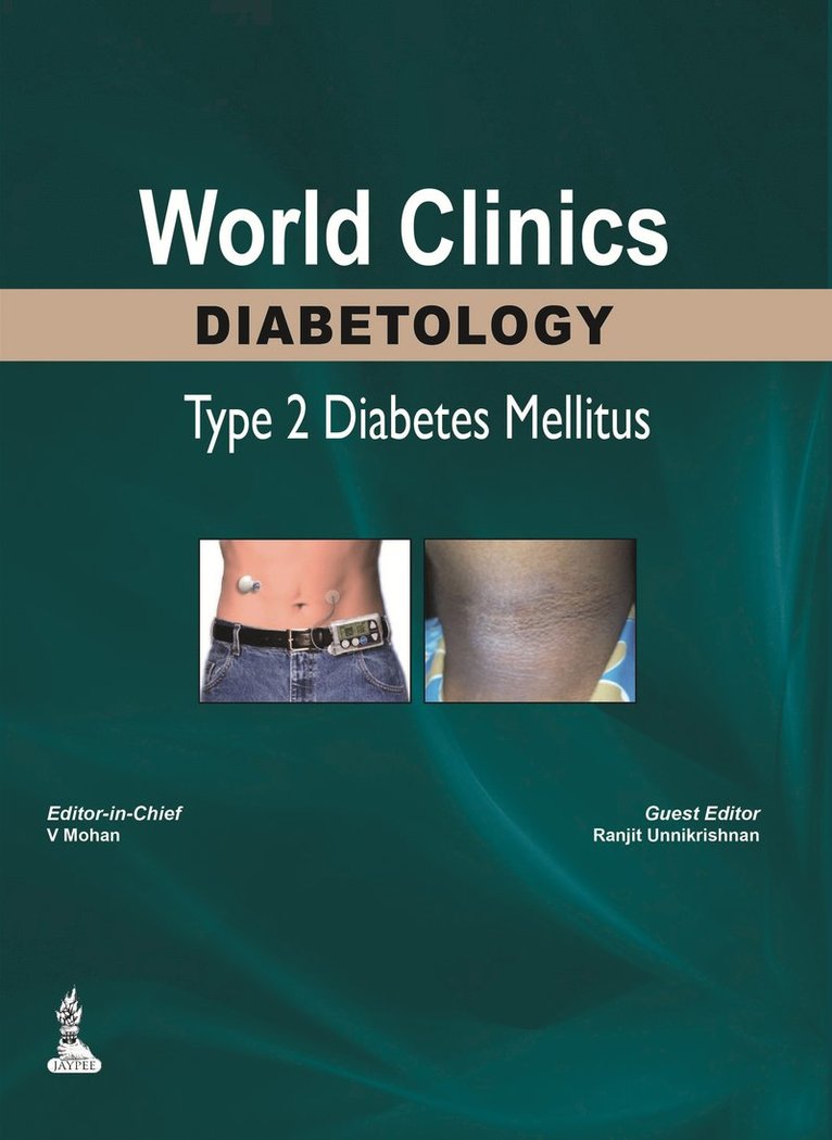 V Mohan, Ranjit Unnikrishnan - World Clinics: Diabetology - Type 2 Diabetes Mellitus, Inbunden