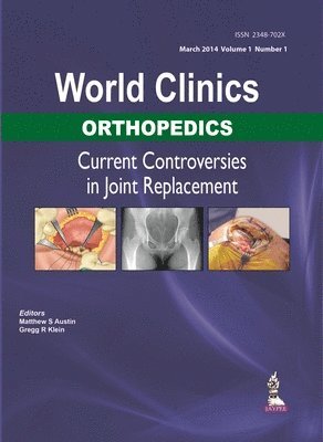 World Clinics: Orthopedics: Current Controversies in Joint Replacement 1