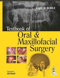 bokomslag Textbook of Oral and Maxillofacial Surgery