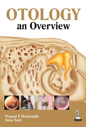 bokomslag Otology: an Overview