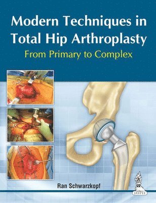 Modern Techniques in Total Hip Arthroplasty 1