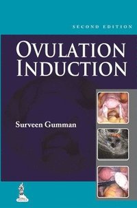 bokomslag Ovulation Induction