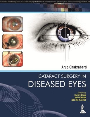 bokomslag Cataract Surgery in Diseased Eyes