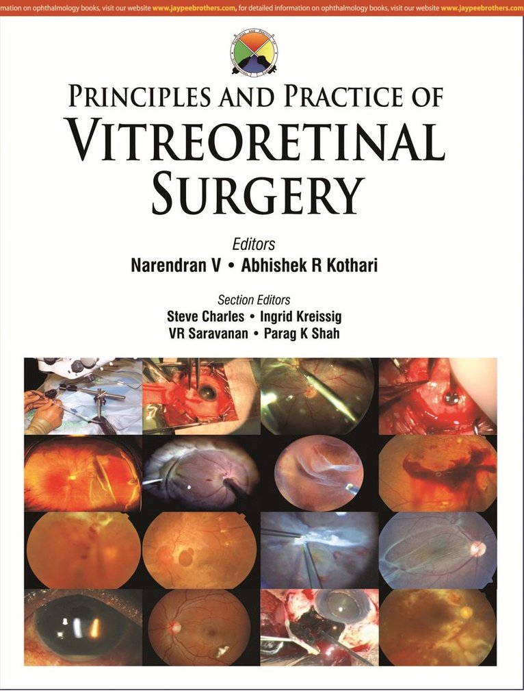 Narendran V, Abhishek Kothari - Principles and Practice of Vitreoretinal Surgery, Inbunden