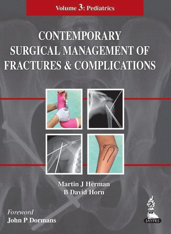 Martin J Herman, B David Horn - Contemporary Surgical Management of  Fractures and Complications, Inbunden
