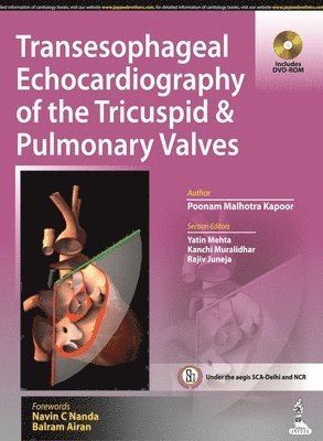 Transesophageal Echocardiography of the Tricuspid & Pulmonary Valves 1