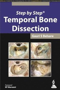 bokomslag Step by Step: Temporal Bone Dissection