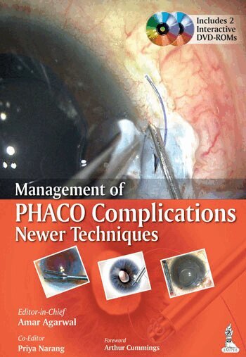 Amar Agarwal - Management of Phaco Complications, Häftad