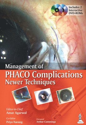 bokomslag Management of Phaco Complications