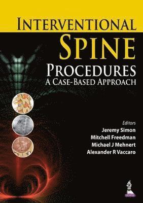 Interventional Spine Procedures 1