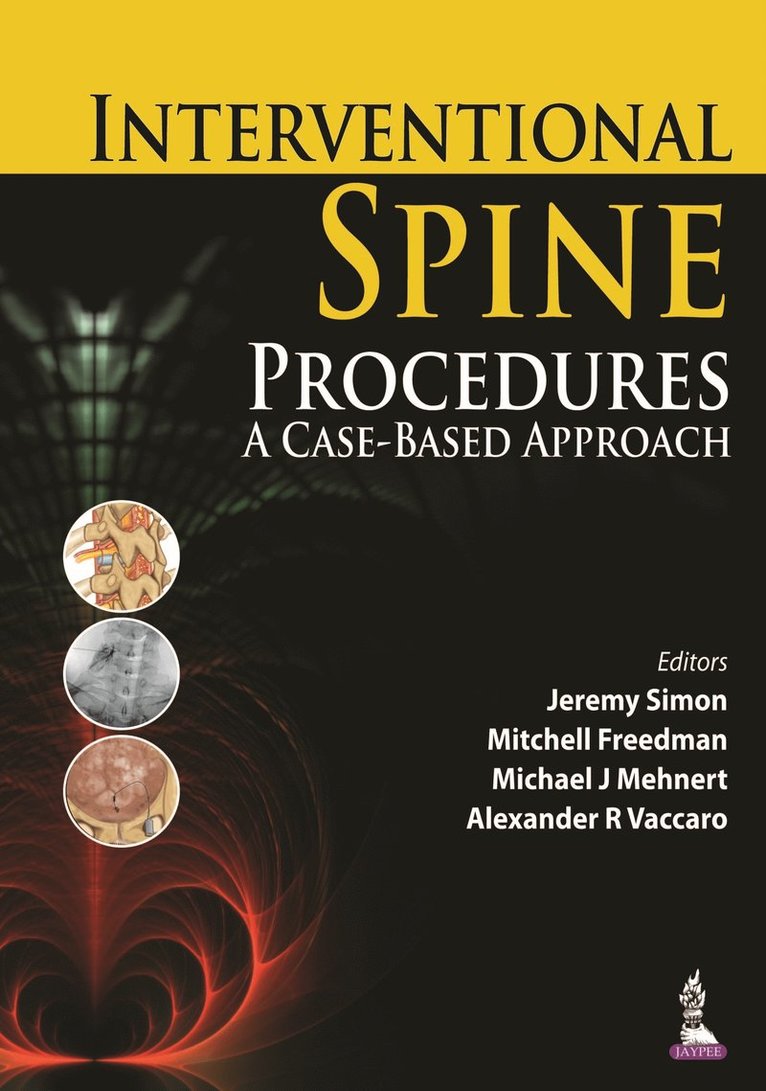 Jeremy Simon, Mitchell Freedman, Michael J Mehnert, Alexander R Vaccaro - Interventional Spine Procedures, Inbunden