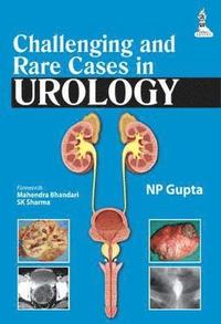 bokomslag Challenging and Rare Cases in Urology