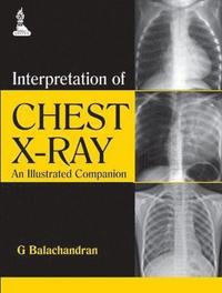 bokomslag Interpretation of Chest X-Ray