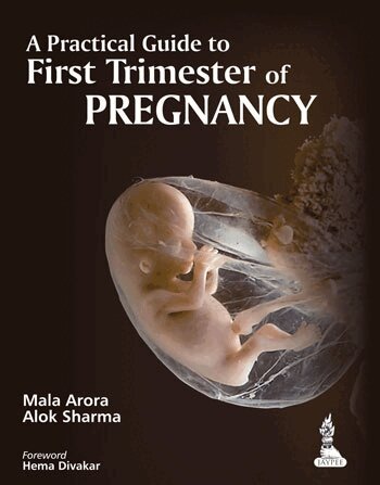 Mala Arora, Alok Sharma - Practical Guide to First Trimester of Pregnancy, Häftad