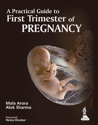 Mala Arora, Alok Sharma - Practical Guide to First Trimester of Pregnancy, Häftad
