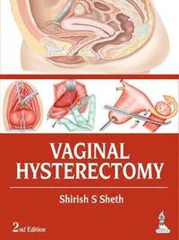 bokomslag Vaginal Hysterectomy