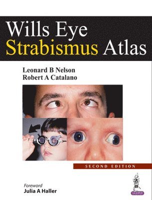 bokomslag Wills Eye Strabismus Atlas