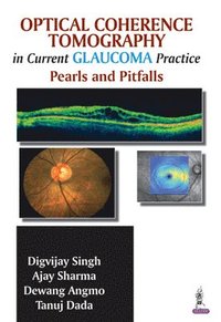 bokomslag Optical Coherence Tomography in Current Glaucoma Practice