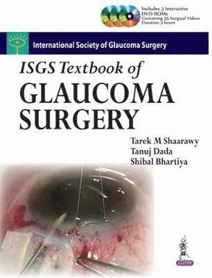 ISGS Textbook of Glaucoma Surgery 1