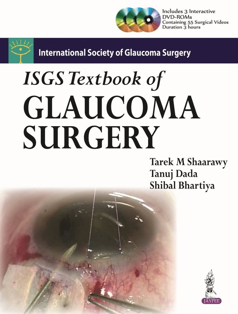 Tarek Shaarawy, Tanuj Dada, Shibal Bhartiya - ISGS Textbook of Glaucoma Surgery, Inbunden