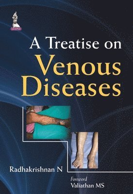 bokomslag A Treatise on Venous Diseases