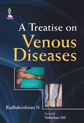 Treatise on Venous Diseases 1
