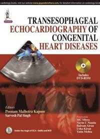 bokomslag Transesophageal Echocardiography of Congenital Heart Diseases