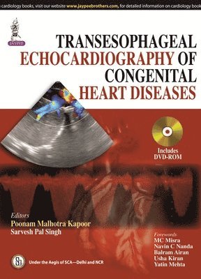 bokomslag Transesophageal Echocardiography of Congenital Heart Diseases