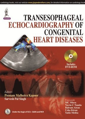 Transesophageal Echocardiography of Congenital Heart Diseases