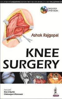 bokomslag Knee Surgery