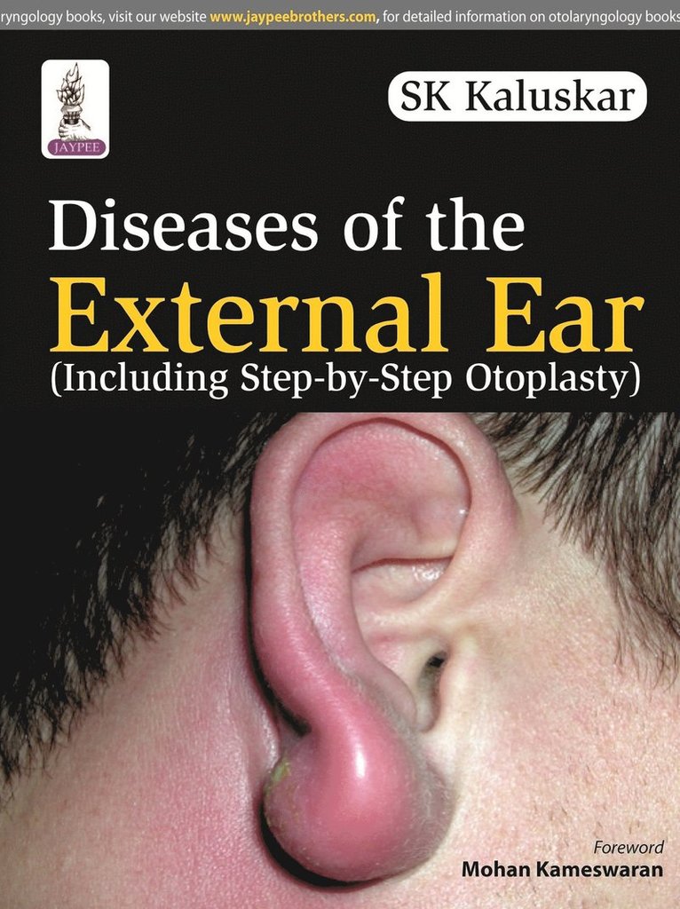 SK Kaluskar, Sk Kaluskar - Diseases of the External Ear, Häftad