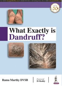 bokomslag What Exactly is Dandruff?