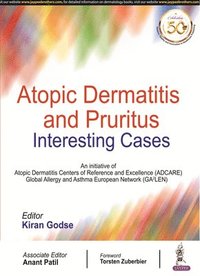 bokomslag Atopic Dermatitis and Pruritus