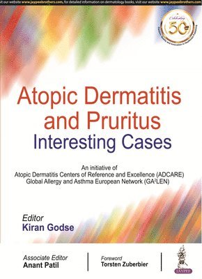 Atopic Dermatitis and Pruritus 1