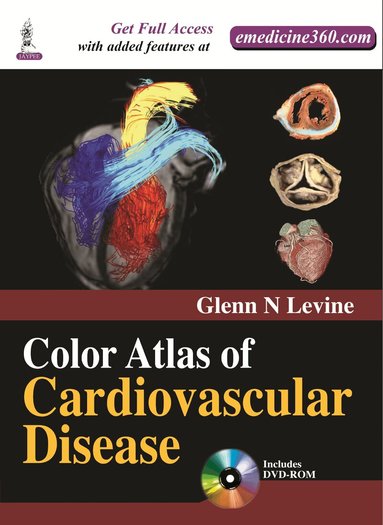 Glenn N Levine - Color Atlas of Cardiovascular Disease, Inbunden
